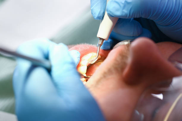 Best Holiday Emergency Dentist in Montgomery, OH