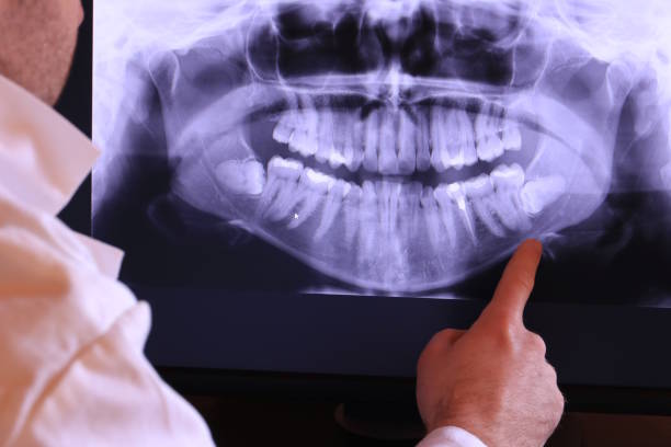 Best Emergency Root Canal Treatment in Montgomery, OH