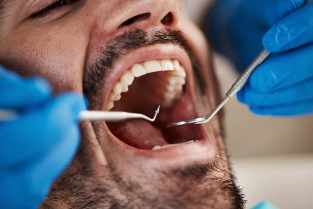 Best Emergency Dental Services for Seniors in Montgomery, OH